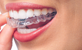 Tandheelkunde volwassenen | Orthodontie